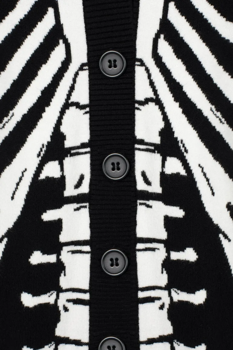 Skeleton Cardigan